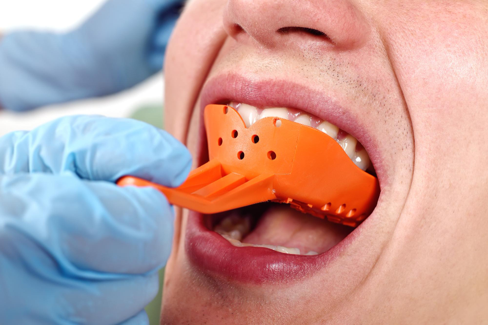 Les solutions durables pour remplacer une ou plusieurs dents